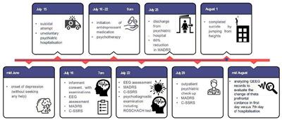 Retrospective analysis of quantitative electroencephalography changes in a dissimulating patient after dying by suicide: A single case report